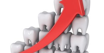 Dental marketing, onmisbaar voor de tandarts van nu